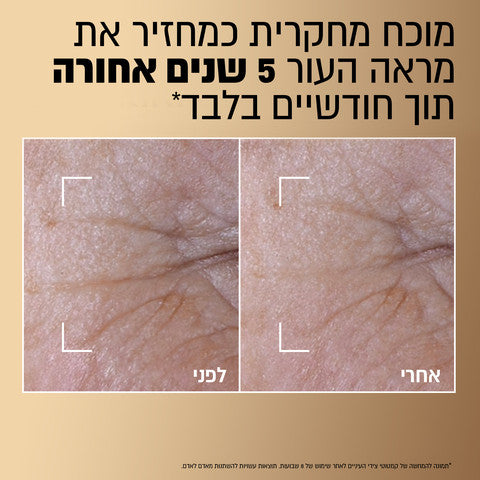 L'Oréal Paris - AGE PERFECT LE DUO סרום