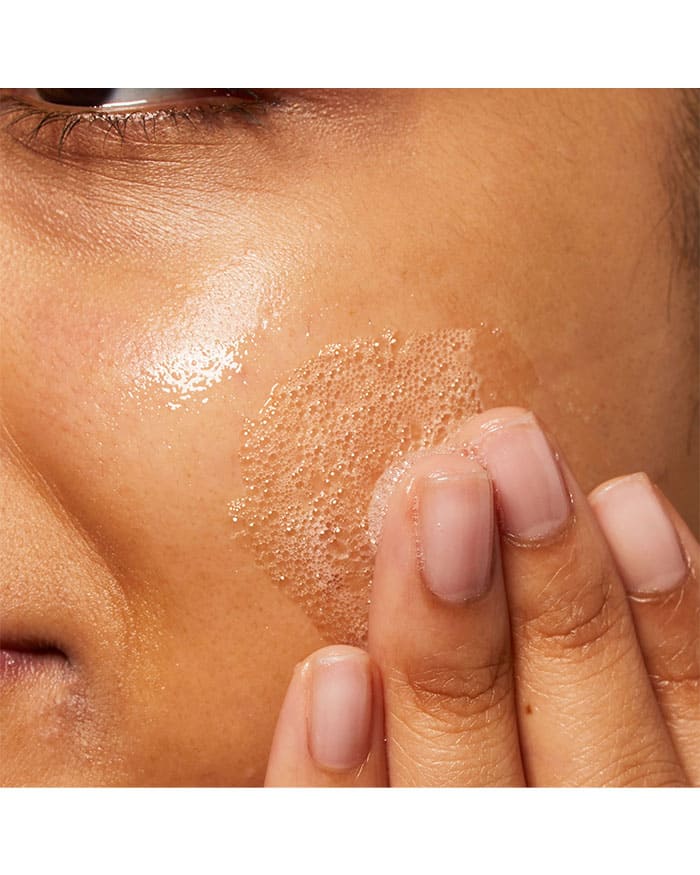 CeraVe - ניקוי לטיפול במראה פגמי העור לעור שמן הנוטה לפצעונים